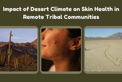 Impact of Desert Climate on Skin Health in Remote Tribal Communities